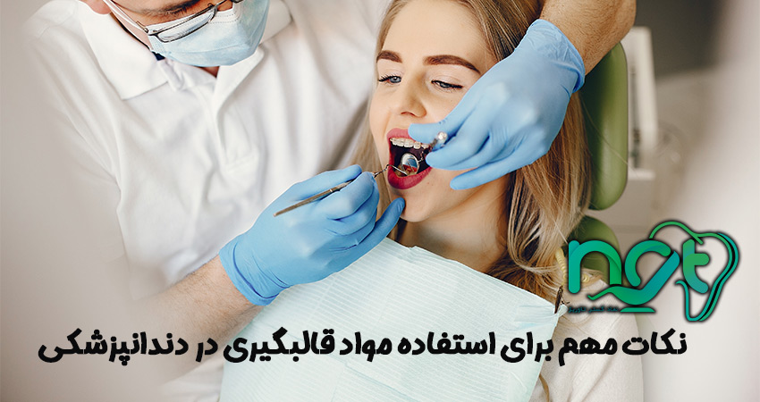   نکات مهم برای استفاده مواد قالبگیری در دندانپزشکی