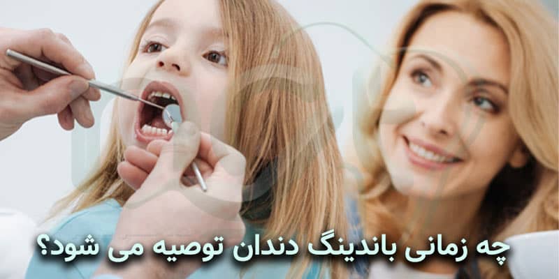 چه زمانی باندینگ دندان توصیه می شود؟